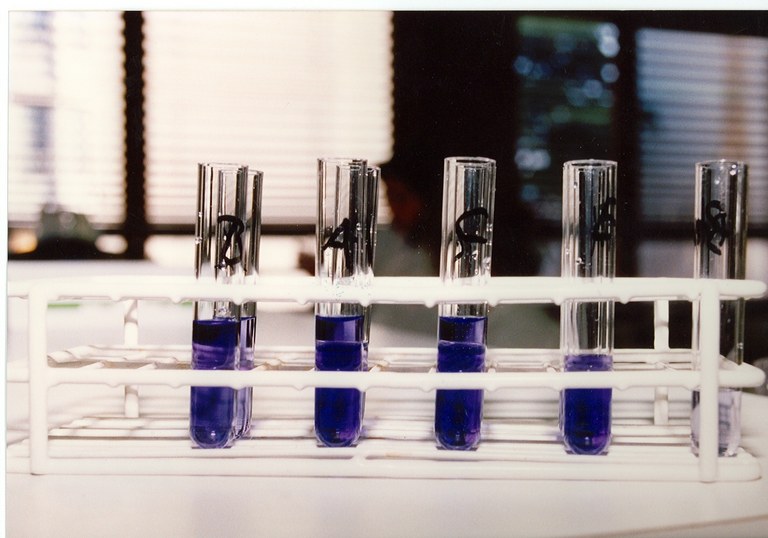 Emboîtant le pas à leurs collègues de l&rsquo;éducation nationale: Les laborantins protestent