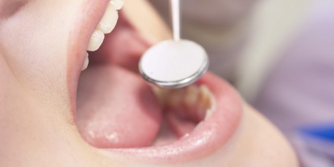 Elle peut avoir des conséquences graves: la carie dentaire une pathologie très fréquente chez les enfants et adolescents