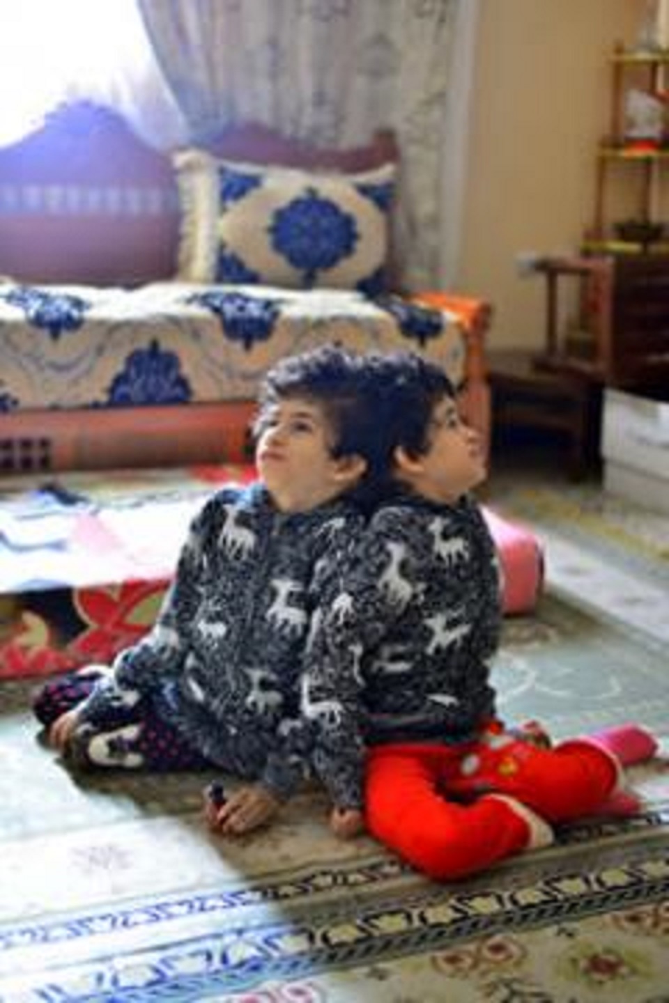 Deux soeurs siamoises lancent un SOS: « Aidez-nous à vivre! »