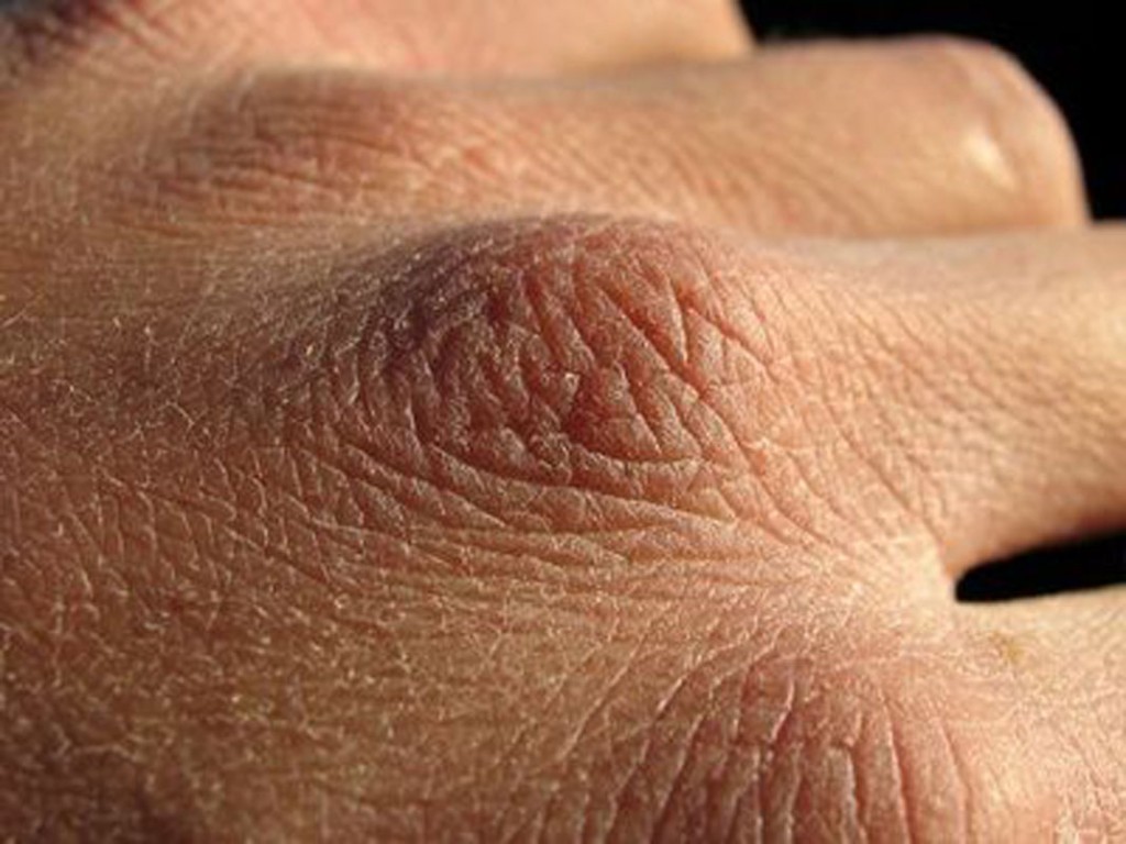 Solution naturelle pour soigner les mains gercées et sèches