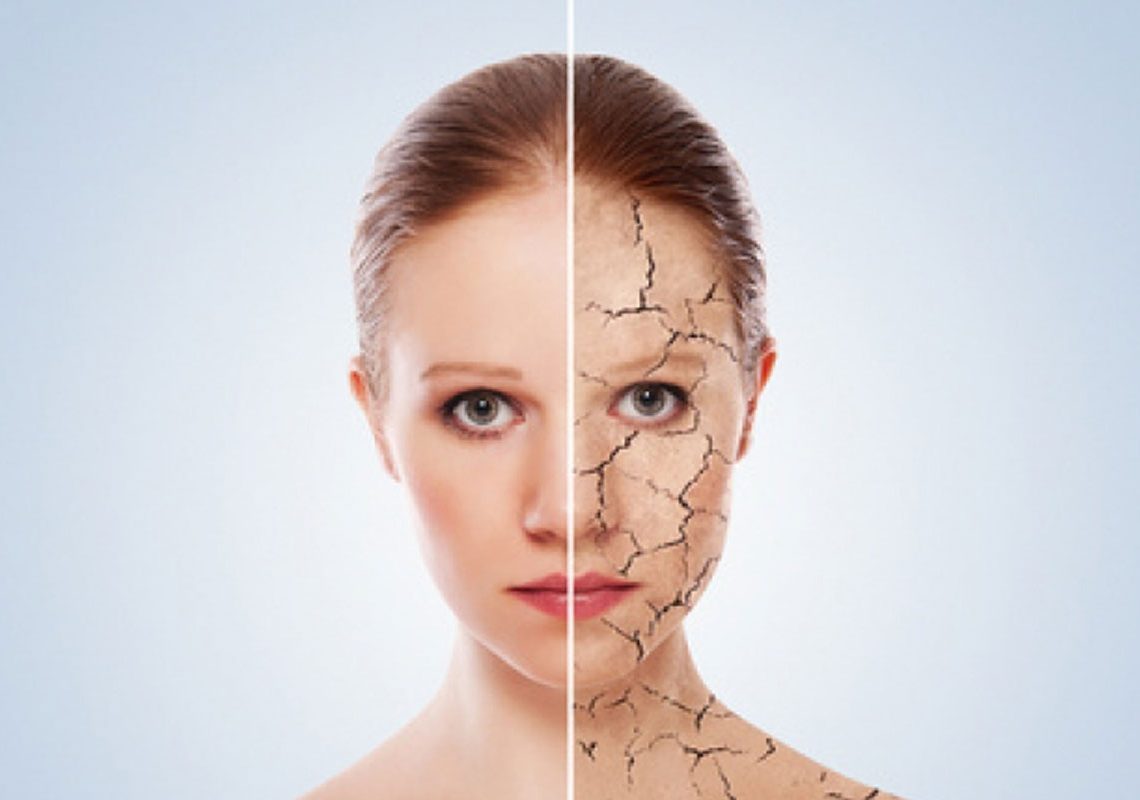 5 Remèdes anti-peau sèche