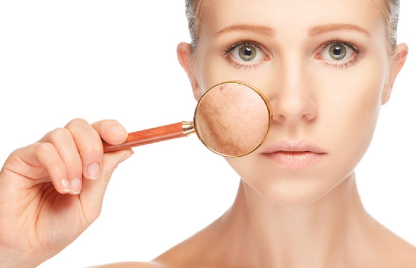 Le citron atténue-t-il les taches brunes de la peau ?