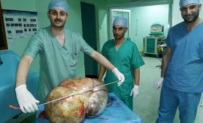 Tissemsilt : on lui enlève un kyste ovarien de 37 kilos