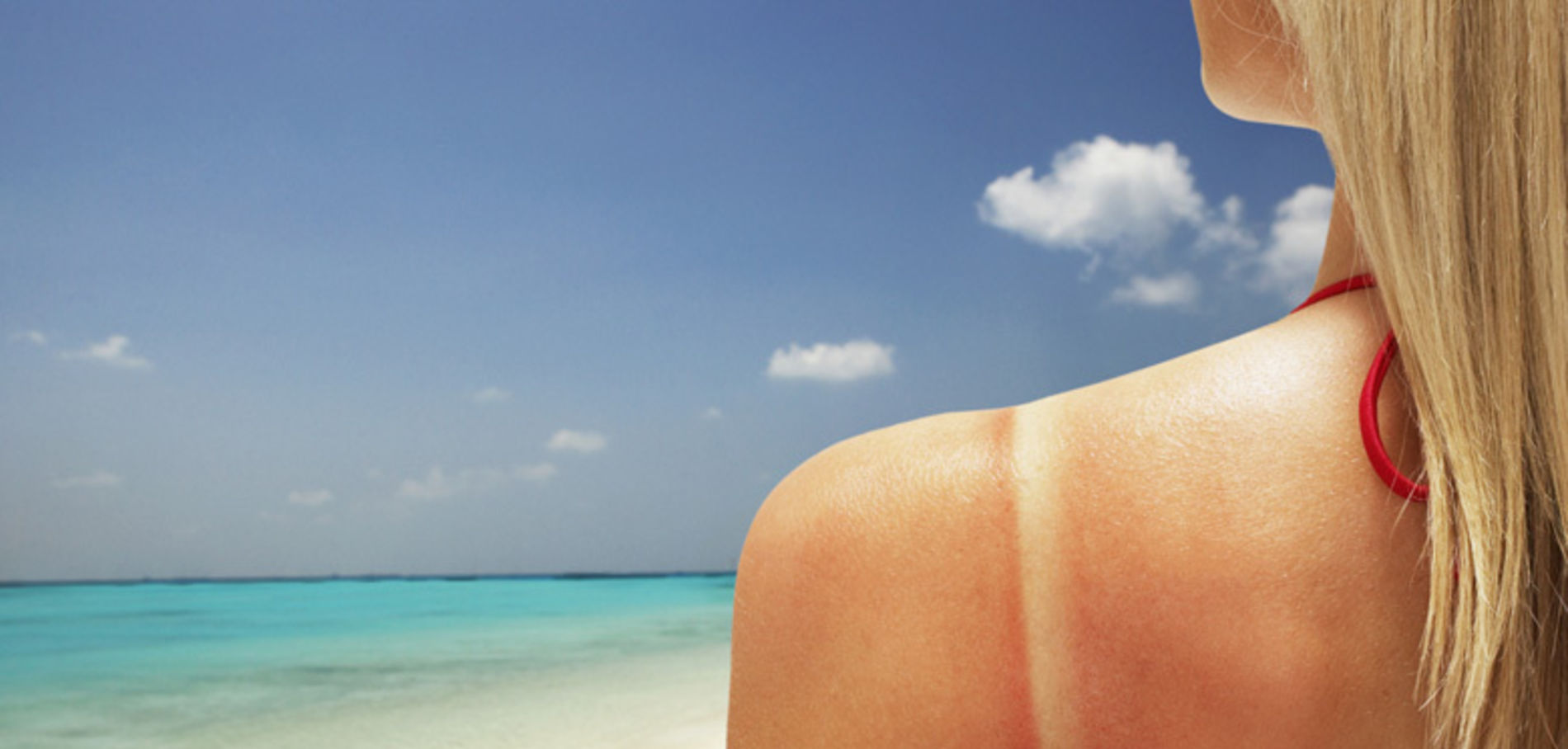 Écran solaire : évitez les erreurs