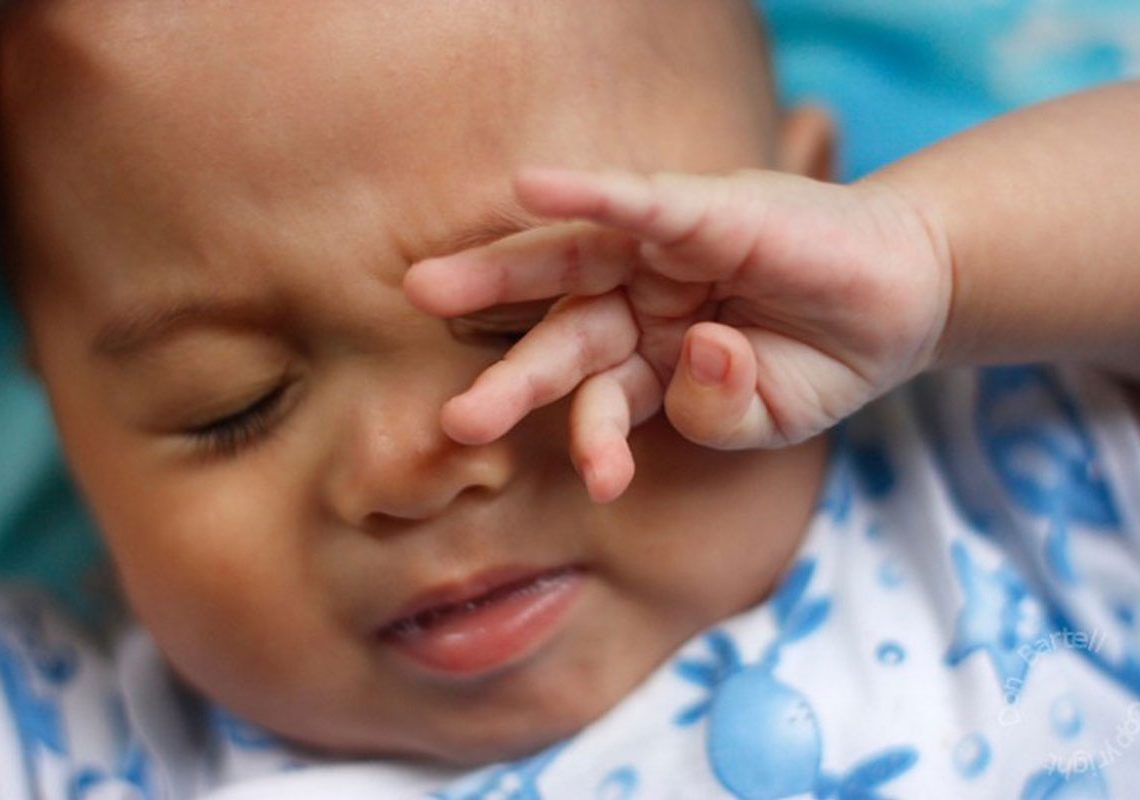 3 Conseils Pour Soigner La Conjonctivite De Bebe Algerie360 3 Conseils Pour Soigner La Conjonctivite De Bebe Algerie360