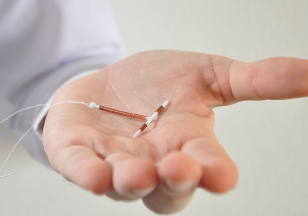 Stérilet: tout savoir sur ce nouveau moyen de contraception