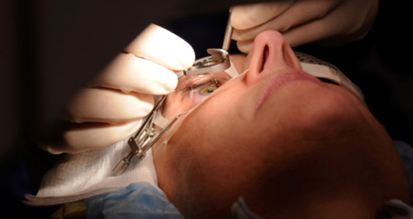 CHU Nafissa-Hamoud d&rsquo;Alger: Une trentaine de greffes de la cornée effectuées