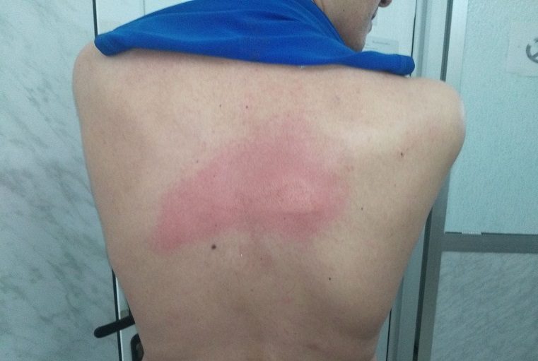 Vidéo: Témoignage de Ghilas Aïnouche, violenté par la police à Béjaïa