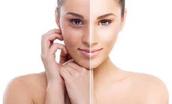 Des ingrédients naturels Pour combattre l’acné