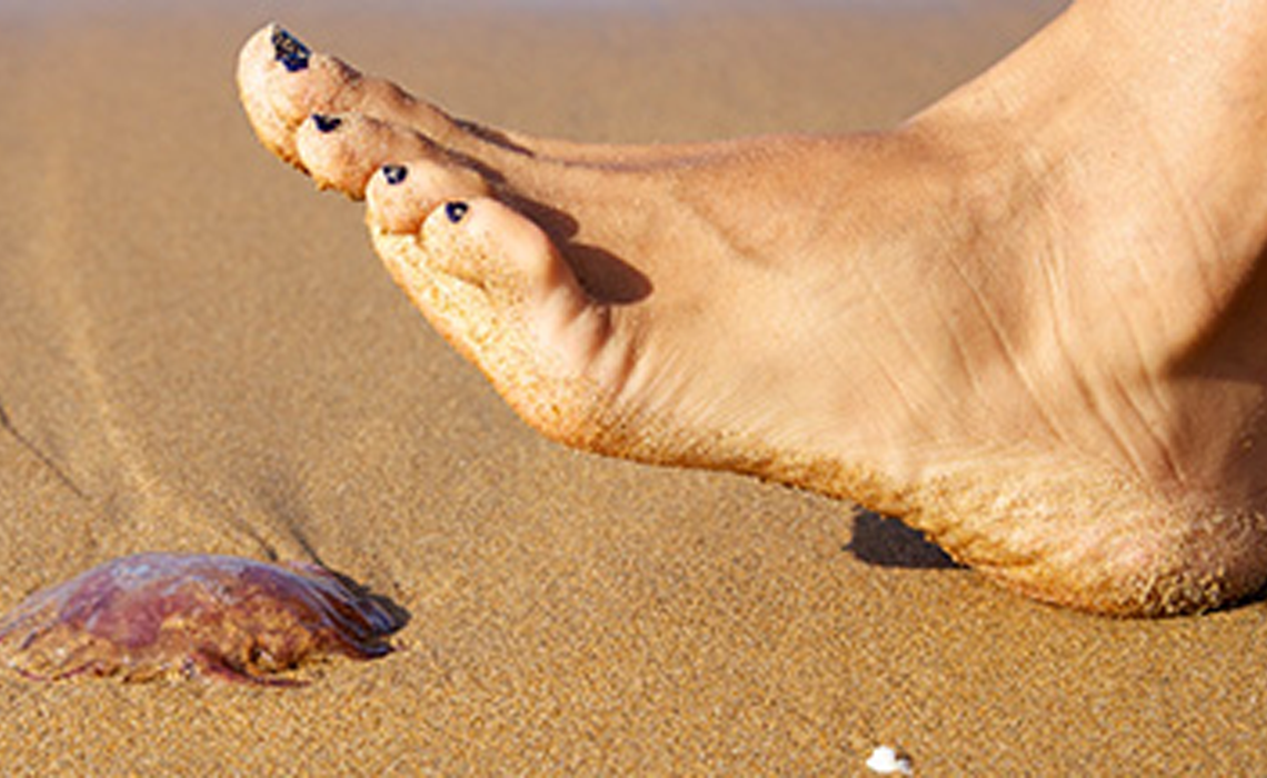 Soulager une piqûre de méduse