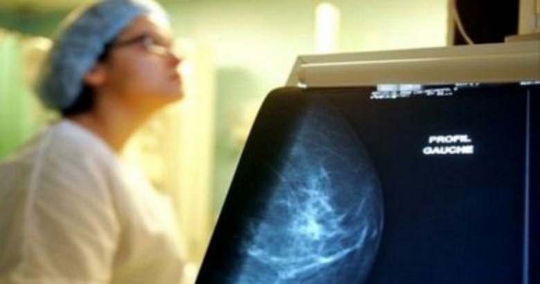 Oran: Développement d’un logiciel informatique qui permet la prédiction de l’évolution des tumeurs cancéreuses