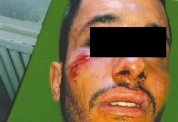 La victime a déposé une plainte au niveau de la police: Un chirurgien-dentiste agresse son patient