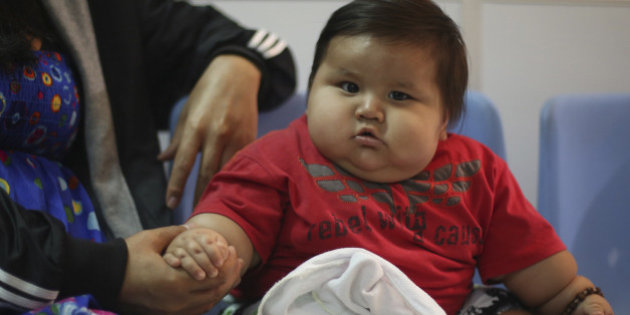 Hausse alarmante de l’obésité et du surpoids chez l’enfant et l’adolescent (OMS)