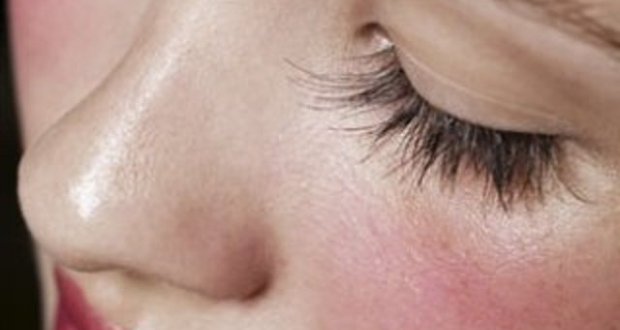 Alerte à la peau rouge ! Une question de discipline