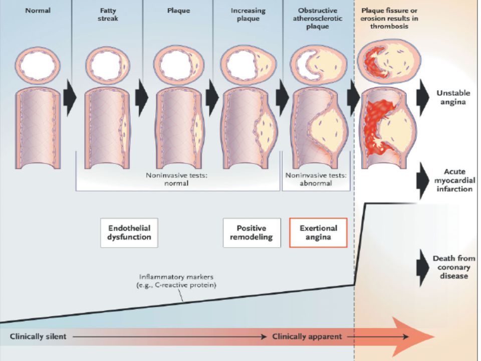 Ce qu’il faut savoir sur l’IDM