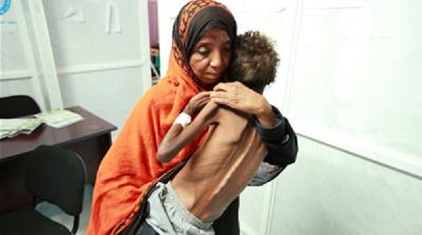 Le conseil de sécurité de l&rsquo;ONU réclame à Ryad de lever le blocus au Yémen, menacé de la pire famine