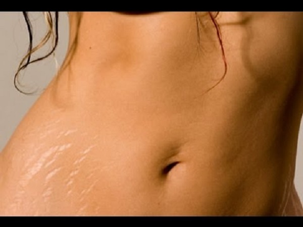 Soins anti-vergetures