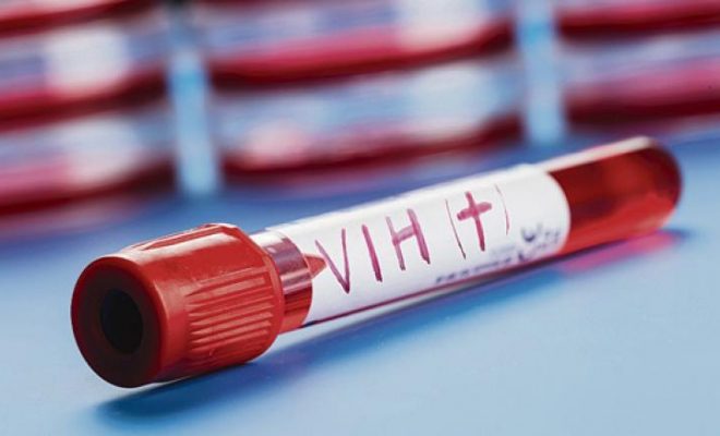 VIH Sida: 82 nouveaux cas dépistés positifs durant le premier semestre 2017