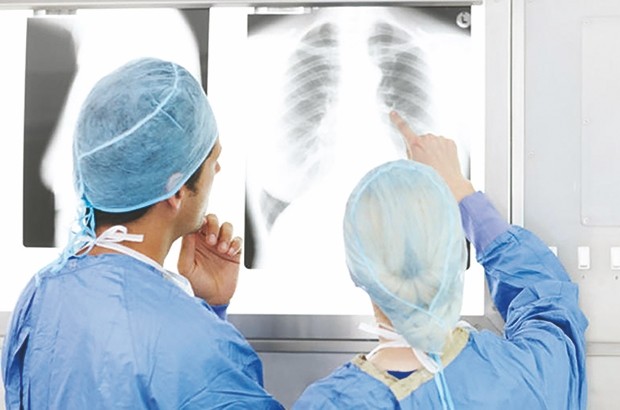 Prise en charge du cancer du poumon: À quand l’enregistrement de l’immunothérapie en Algérie ?