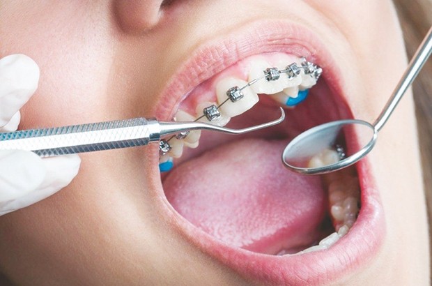 Sixième congrès de la SAO : L’orthodontie et la pluridisciplinarité en débat