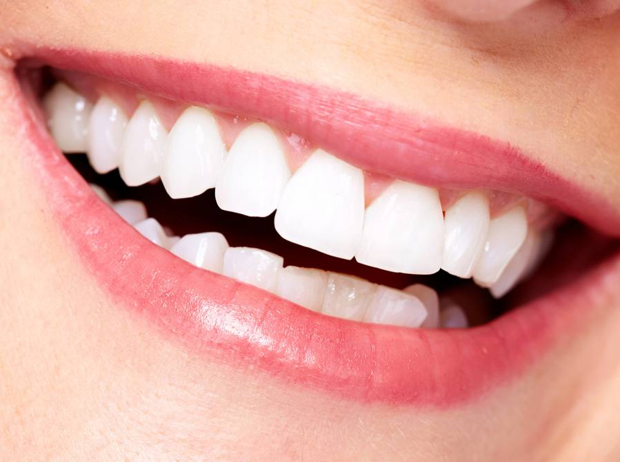 Pourquoi nos dents perdent de leur blancheur