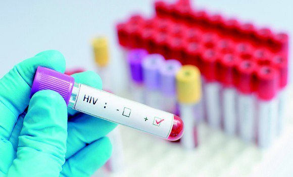 Les enfants atteints de sida : un secret lourd à porter