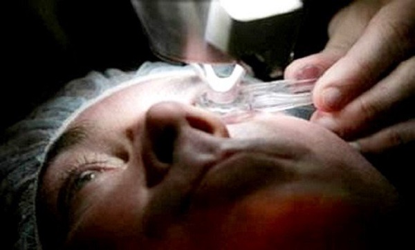 Greffe de la cornée: plaidoyer pour la sensibilisation au consentement du donneur