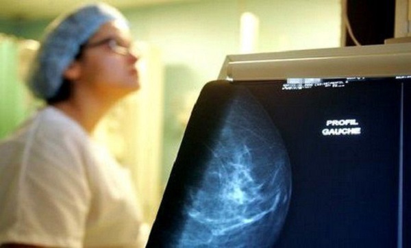 Les résultats de l&rsquo;étude nationale sur le cancer du sein annoncés en juin
