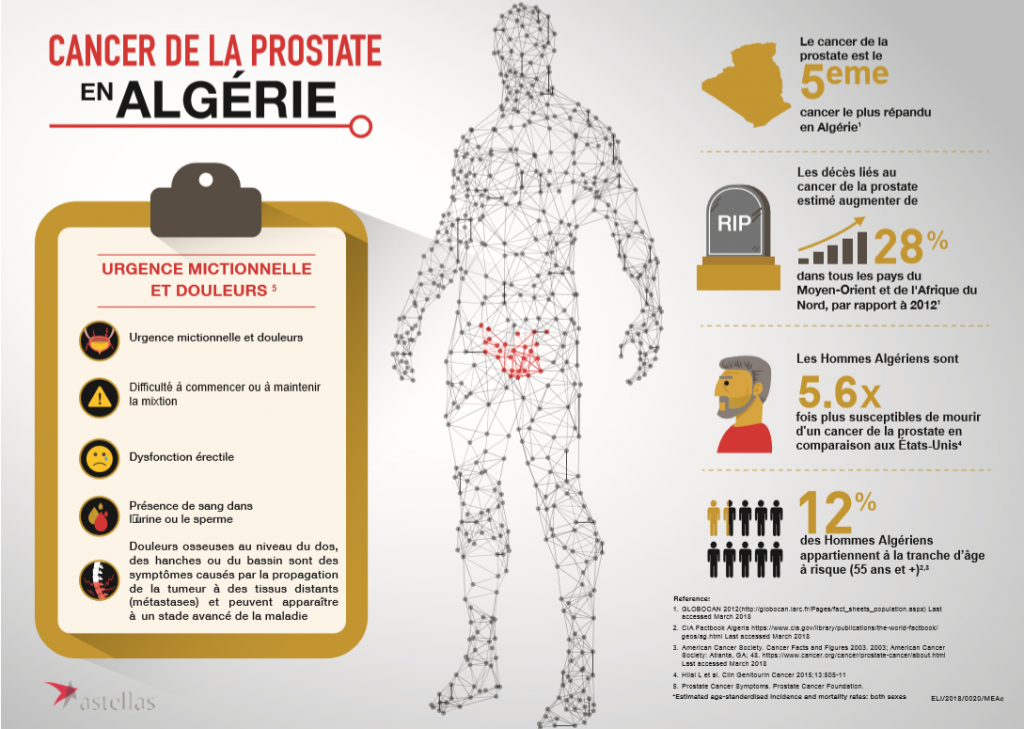 La détection précoce du cancer de la prostate est la clé pour augmenter le taux de survie des hommes en Algérie