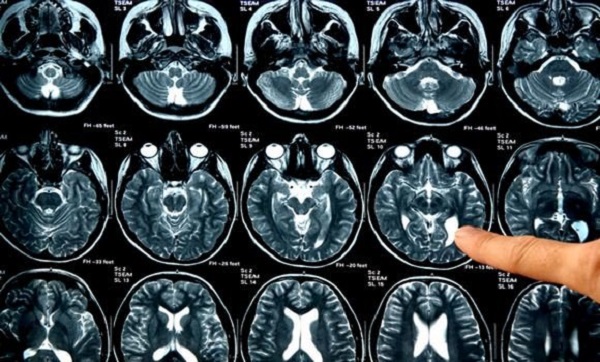 Développement d&rsquo;un système au service des personnes aux besoins spécifiques