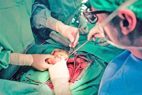 Transplantation d’organes à partir de cadavres : Journée de sensibilisation au profit des citoyens à Tizi Ouzou