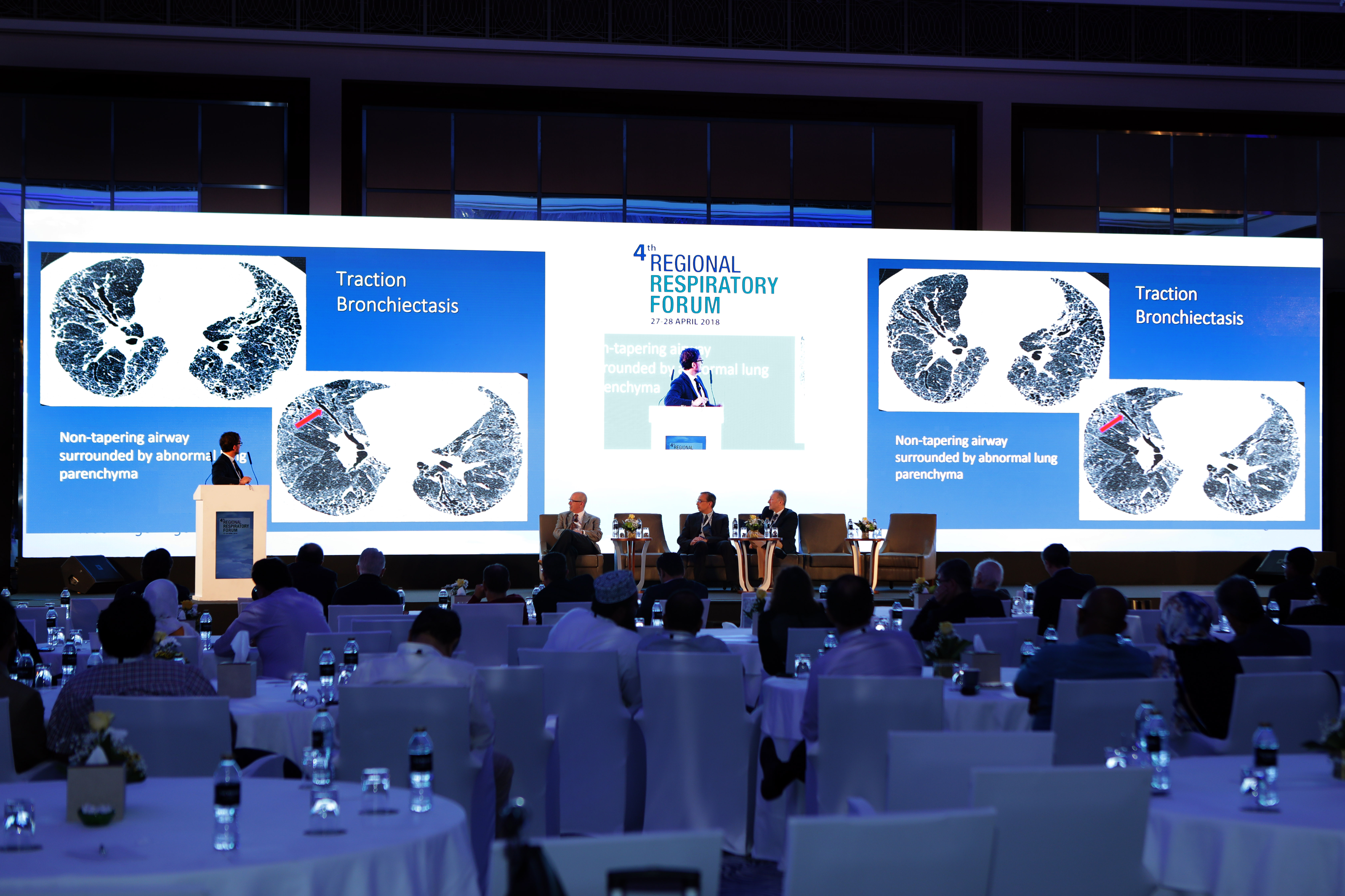 La prévalence accrue des maladies pulmonaires au Moyen-Orient et en Afrique du Nord pèse lourdement sur les systèmes de soins de santé