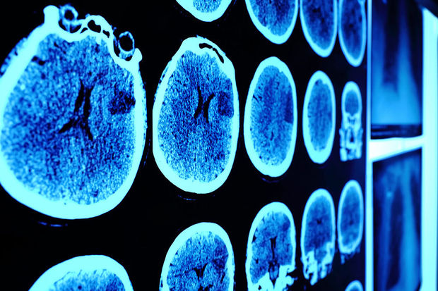 Neurochirurgie : L’Algérie désignée comme un centre de formation aux résidents africains