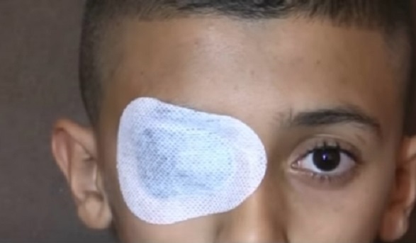 Batna : Un élève blessé à l’œil par son enseignante de mathématique