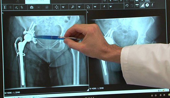 Plus de 250 spécialistes attendus au prochain congrès national de la SACOT