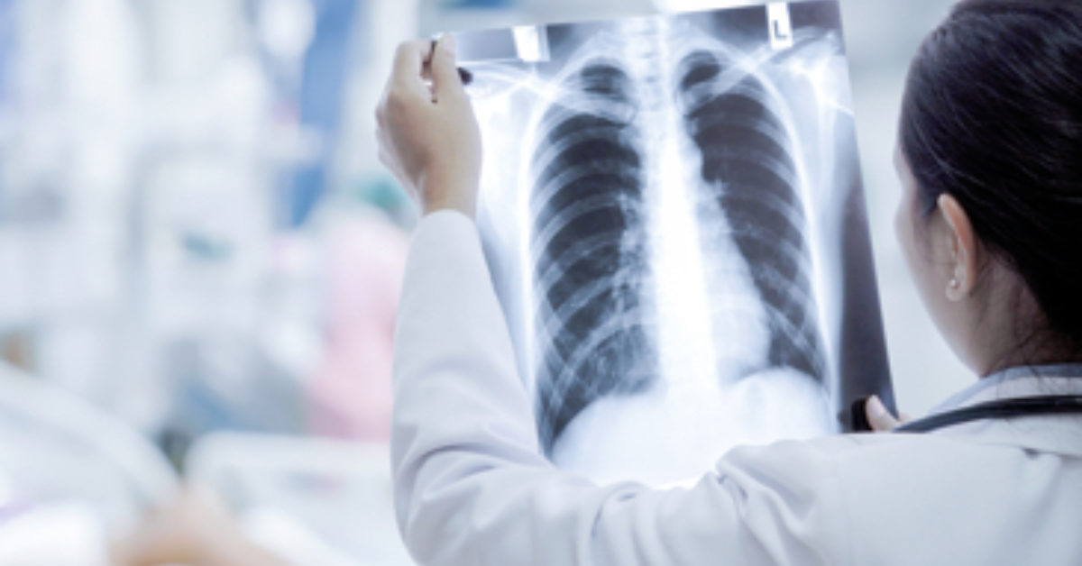 Congrès international de pneumologie: «Il y a 40% de patients qui continuent de fumer»