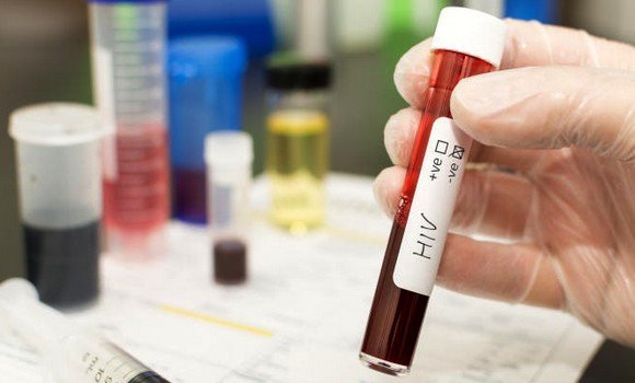 Plus de 12.000 cas de VIH/SIDA enregistrés en Algérie depuis 1985