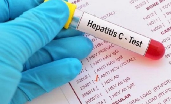 Tébessa – Hépatite C : une centaine de malades recensée