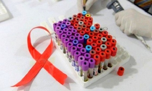 SIDA: 637 nouveaux cas enregistrés au CHU d’Oran en 2018