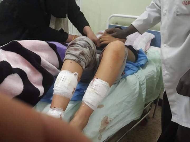 Ouargla: Treize enfants blessés dans l’explosion d’une bombe à l’acide