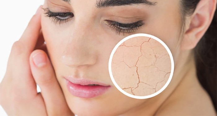 Santé : Peau sèche, irritations