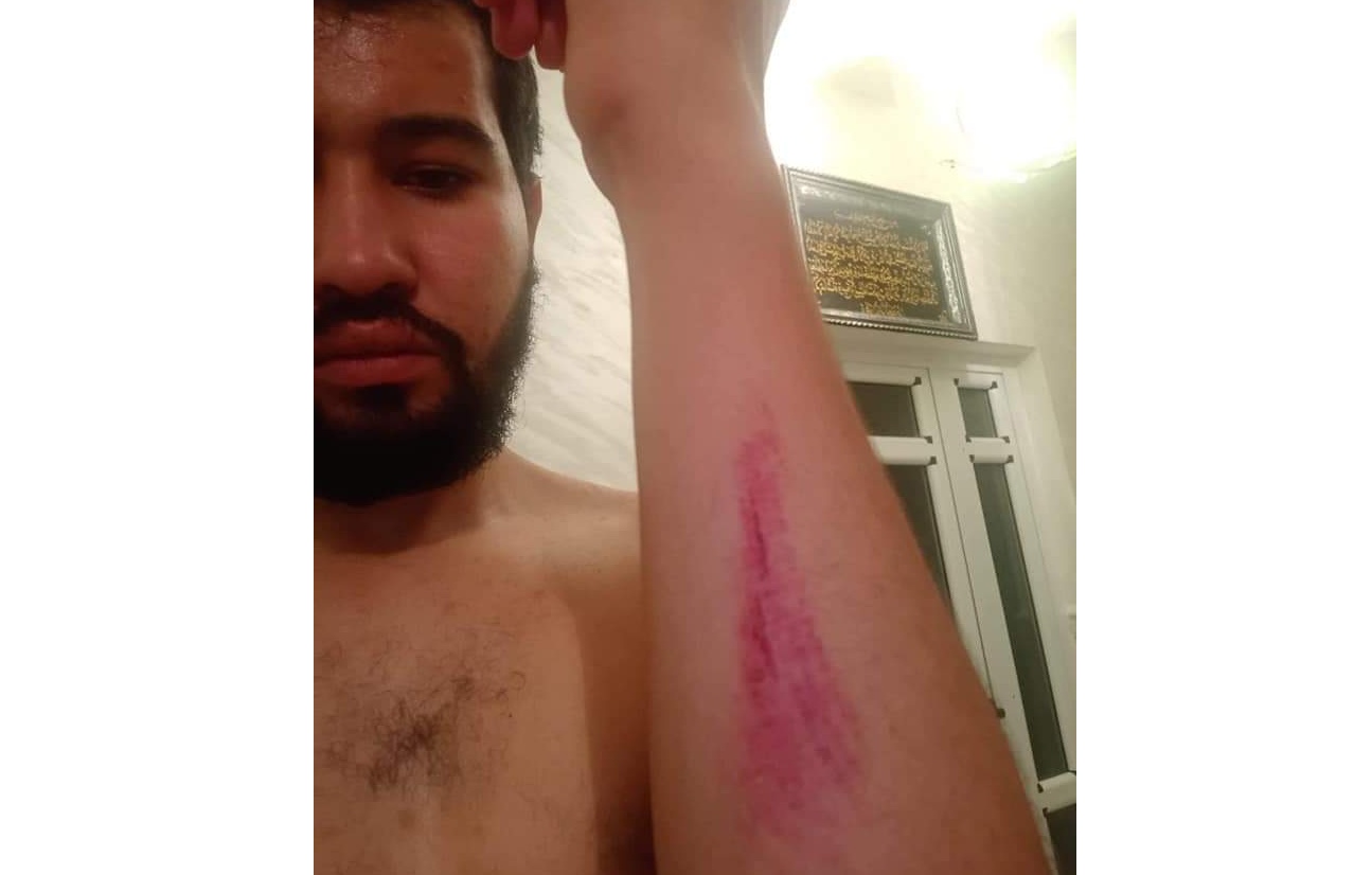 Un journaliste agressé par des policiers à Annaba !