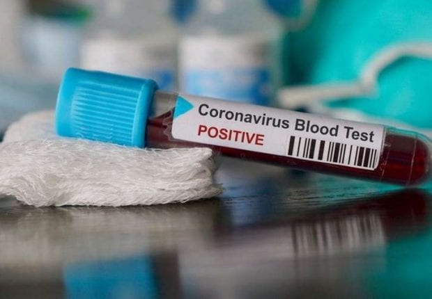 Coronavirus en Algérie : 4 cas confirmés et 89 personnes mises en quarantaine à Skikda