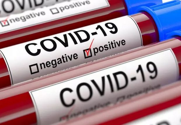 Coronavirus Algérie : un producteur pharmaceutique algérien propose un traitement