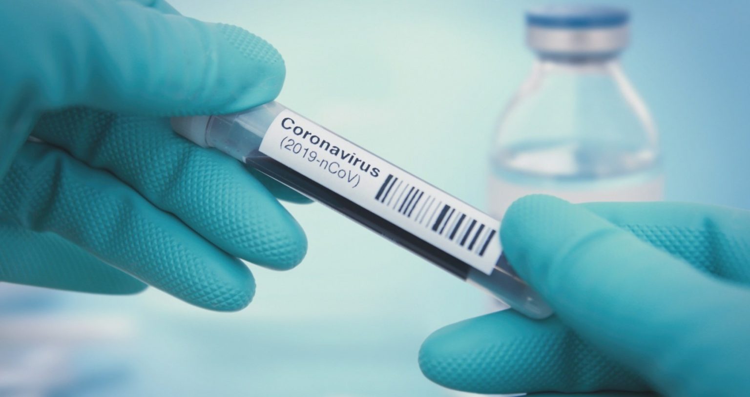 Coronavirus : « Le Virus est sorti d’un laboratoire chinois avec de l’ADN de VIH » (Pr Montagnier)