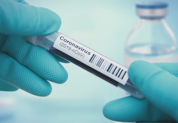 Coronavirus : « Le Virus est sorti d’un laboratoire chinois avec de l’ADN de VIH » (Pr Montagnier)