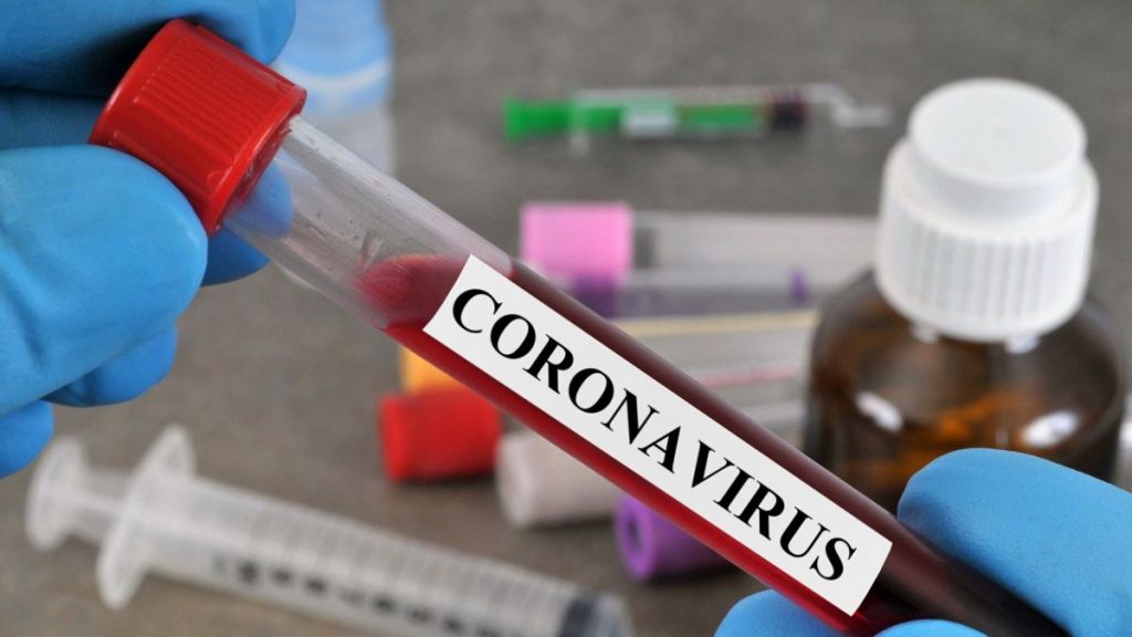 Pour le professeur Nafti, le pic de l’épidémie du Coronavirus n’est pas encore atteint