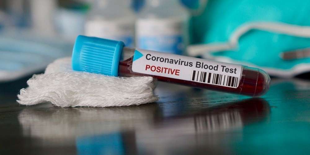 Coronavirus : Voila pourquoi le nombre de cas contaminés a baissé