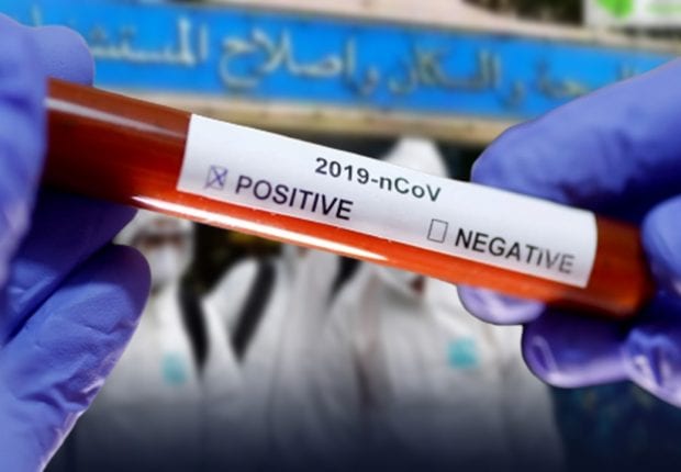 Coronavirus : l’Algérie lance la production d’un test de dépistage rapide  