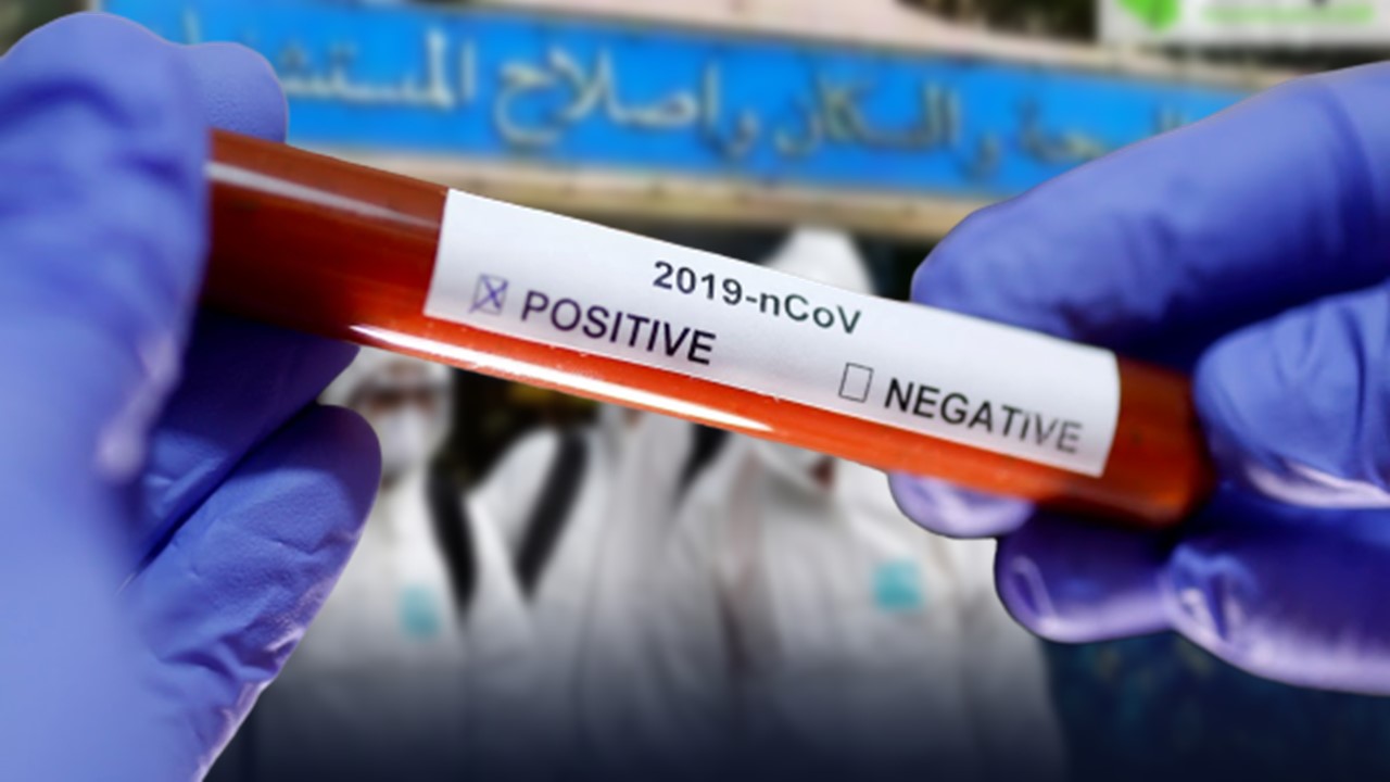 Coronavirus : l’Algérie lance la production d’un test de dépistage rapide  